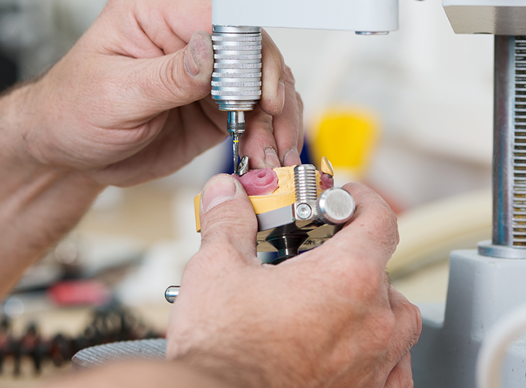 Ausschnitt-zahntechniker arbeitet an einem zahnersatz-contrastwerkstatt-AdobeStock_42157192