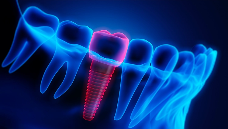 Dentin_iStock-1325605030 B. Engels