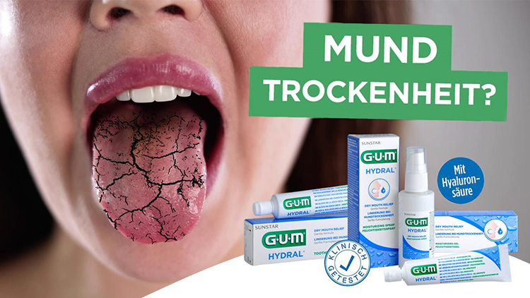 Warum sich bei Mundtrockenheit eine ausfhrliche Anamnese und Diagnostik  lohnt | Dentalwelt