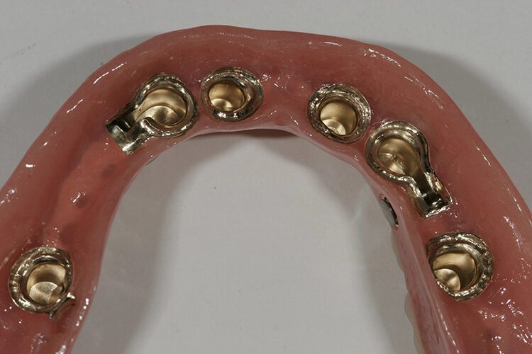 Abb. 105: Ein sauberer, klar definierter Übergang von Rosa zu Gold.