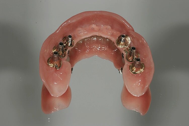 Abb. 110: … und Oberkiefer von basal.