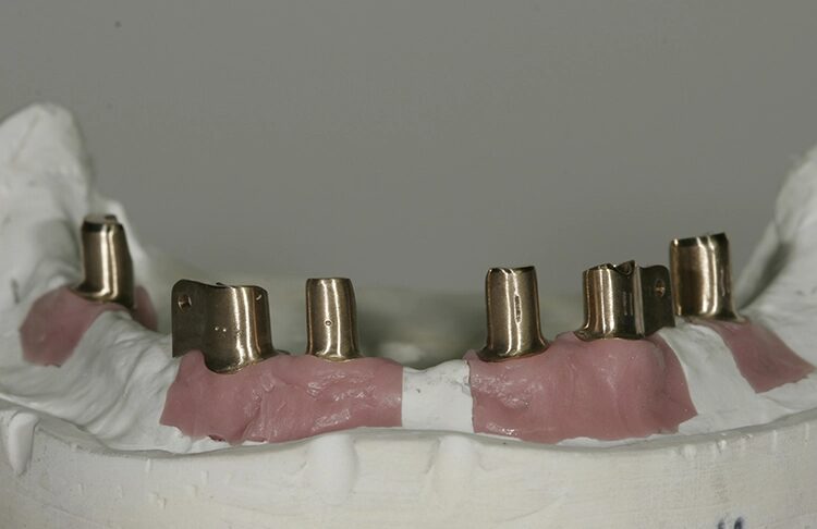 Abb. 112: … und Unterkiefer sind beschriftet.