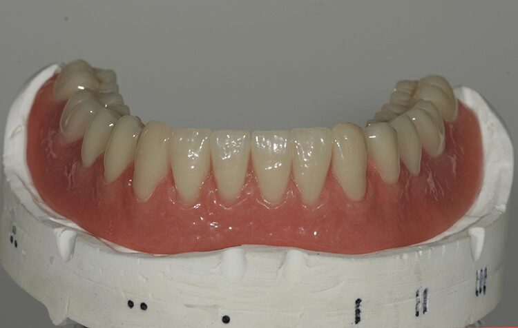 Abb. 116: Lediglich im Unterkiefer mit etwas Leben.