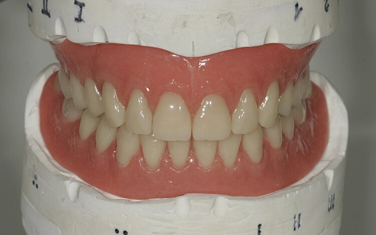 Abb. 117: Eine funktionelle, gleichmäßige Verzahnung.