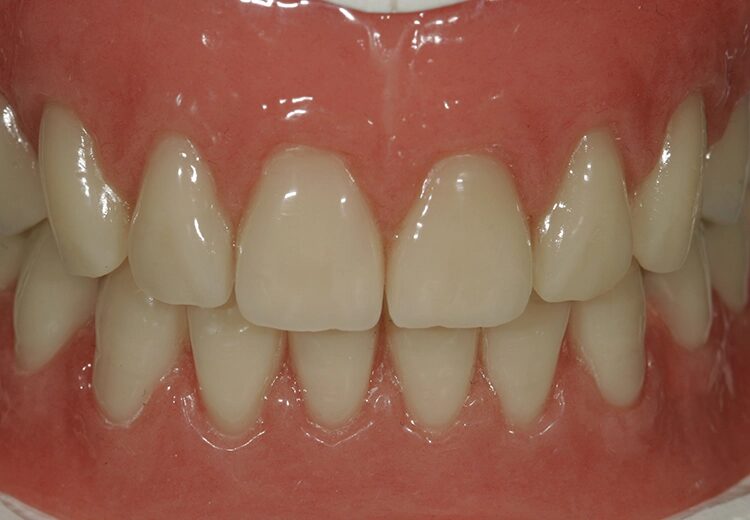 Abb. 119: Die natürliche Schneidekante im Detail.