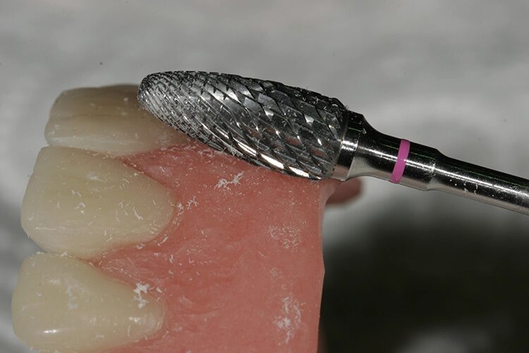 Abb. 98: Mit dem H251 EQ lassen sich die Details schnell und effizient ausarbeiten.