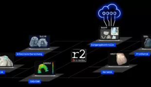 Die Abbildung zeigt ein digitales Ökosystem für die Zahntechnik, dargestellt durch eine stilisierte Plattform mit mehreren vernetzten Arbeitsbereichen. Jeder Bereich ist durch ein Laptop-Symbol mit spezifischer Software visualisiert und trägt eine thematische Beschriftung in blauer Farbe. Im Zentrum des Bildes befindet sich das Logo „r2 – dei ex machina“, welches vermutlich für die zentrale Steuerung oder das Hauptsystem steht. Folgende Bereiche sind dargestellt: Orthodontik (unten links) – Gezeigt wird ein Modell eines Gebisses mit einer digitalen Schiene (Software: EasyTrainer). Arbeitsvorbereitung (mittig links) – Visualisiert durch Gitterstrukturen für Modelle und Abformungen (Software: Fix it Erik). CAD/CAM (unten mittig) – Eine farbcodierte Qualitätskontrolle eines digitalen Modells (Software: QualityCheck). Eingangskontrolle (oben mittig) – Darstellung von digitalen Scans und Modellen mit verschiedenen Zahnersatzteilen (Software: MasterCP), verbunden mit einer Cloud-Grafik, die auf zentrale Datenverarbeitung oder -speicherung hinweist. Prothetik (oben rechts) – Abgebildet sind Zahnersatzteile wie Totalprothesen oder Kiefermodelle (Software: BiteReg). Keramik (mittig rechts) – Ein bearbeitetes Keramik-Zahnmodell (Software: cad2cad Fräse). Das Bild vermittelt den Workflow in einem digitalen zahntechnischen Labor, von der Eingangskontrolle über Design, Fertigung und Qualitätskontrolle bis hin zur finalen Ausarbeitung – vollständig vernetzt und softwaregestützt.