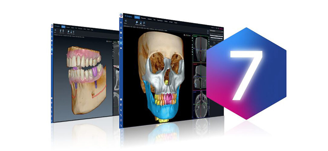 Bildgebungssoftware Romexis 7 mit integrierter KI