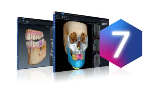 Bildgebungssoftware Romexis 7 mit integrierter KI