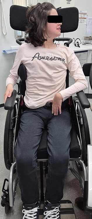 Abb. 1: 18-jährige Patientin im jungen Erwachsenenalter mit Rett-Syndrom (Stadium 4) kurz vor der zahnärztlichen Kontrolluntersuchung (Foto: D. John/P. Briotti-Ferreira, UKU).
