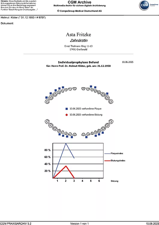 Abb. 9d: Supragingivale Beläge wurden zur reproduzierbaren Bestimmung der Effektivität der aktuellen Mundhygiene bei dem in Abbildung 8 vorgestellten Patienten im Rahmen der systematischen stufenweisen parodontalen Therapie angefärbt (a–c) und dokumentiert (d). Bei einigen Anfärbehilfen lassen sich durch unterschiedliche Färbungen frische und ältere Beläge und/oder Zahnstein voneinander differenzieren. Aufgrund der besseren Sichtbarkeit einer Blutung ist es jedoch sinnvoll, vor dem Anfärben zunächst die gingivale Blutungsneigung zu erfassen. Bei diesem Patienten führte das vorsichtige flache Ausstreichen des gingivalen Sulkus mit einer stumpfen Sonde zu keiner detektierbaren Blutung am Untersuchungstag. Die Informationsgrafik (d) mit den individuellen „Schwachstellen“ wurde automatisch digital erstellt und dem Patienten ausgehändigt. In aller Regel lassen sich diese Blätter entsprechend dem sonstigen Erscheinungsbild der Praxis (Corporate Identity) anpassen. Nach Dokumentation des Ist-Zustandes erfolgte die individuelle Mundhygieneinstruktion. Sie umfasste die Umstellung auf eine elektrische rotierende Zahnbürste mit einem runden Borstenkopf sowie die Anwendung von Interdentalraumbürstchen (e) dreier unterschiedlicher Größen in den produktspezifischen Farbkodierungen: rosa, rot und gelb (Tepe, Schweden). Bei einigen Patienten/-innen sind die Interdentalräume mitunter aber auch durch Zahnstein/ Konkremente verblockt, sodass gar kein Zahnzwischenraumbürstchen passen kann. Hier ist es dann ratsam, die Instruktionen zur Optimierung der Mundhygiene erst nach einer Beseitigung der mineralisierten Beläge beispielsweise im Rahmen einer professionellen Zahnreinigung vorzunehmen.