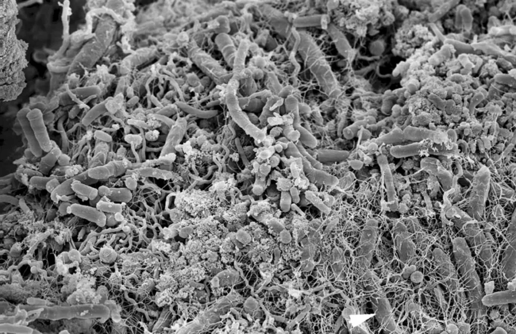 Abb. 2: Rasterelektronenmikroskopische Aufnahme eines oralen Biofilms. Die Abbildung zeigt die enorme Formenvarianz oraler Bakterien. Eine extrazelluläre Matrix aus Exopolysacchariden umgibt dabei die Mikroorganismen. Diese besondere Struktur stellt einen Schutz dar und „sorgt“ unter anderem dafür, dass antimikrobielle Wirkstoffe oder Bestandteile des Immunsystems die eingeschlossenen Bakterien nur sehr eingeschränkt oder auch gar nicht erreichen können. Die therapeutische Relevanz liegt daher darin, dass ein oraler Biofilm durch die häusliche Mundhygiene regelmäßig mechanisch zerstört werden muss, um ein Gleichgewicht zwischen der Wirtsabwehr und dem mikrobiellen Reiz herzustellen (zur Verfügung gestellt von C. Schaudinn, Robert-Koch-Institut, Berlin, Deutschland).