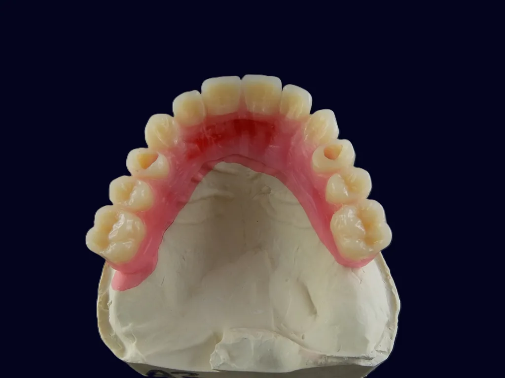 Abb. 2b: Gute Ausgangssituation, lediglich das Implantat Regio 22 stand prothetisch nicht optimal.