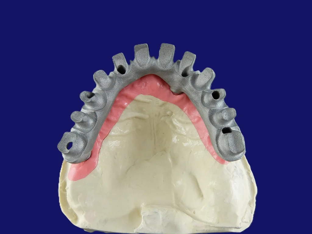 Abb. 4a: Auf Grundlage der Wachsaufstellung wurde ein Cut-back am Gerüst für Kronen und Gingiva-Anteil vorgenommen.