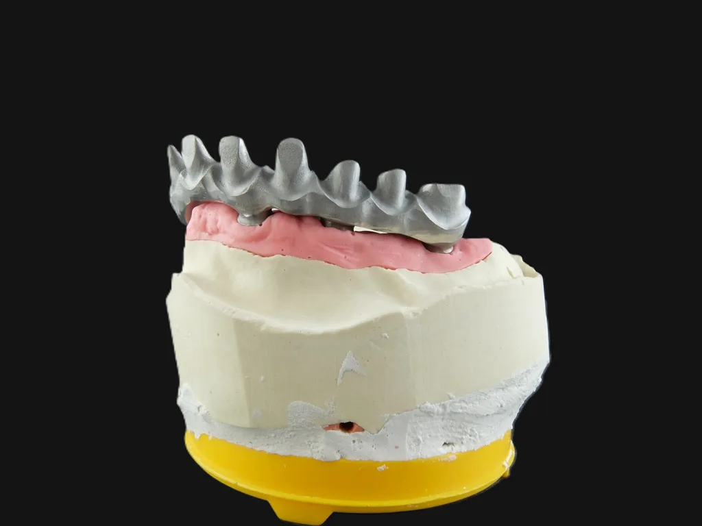 Abb. 4b: Auf Grundlage der Wachsaufstellung wurde ein Cut-back am Gerüst für Kronen und Gingiva-Anteil vorgenommen.