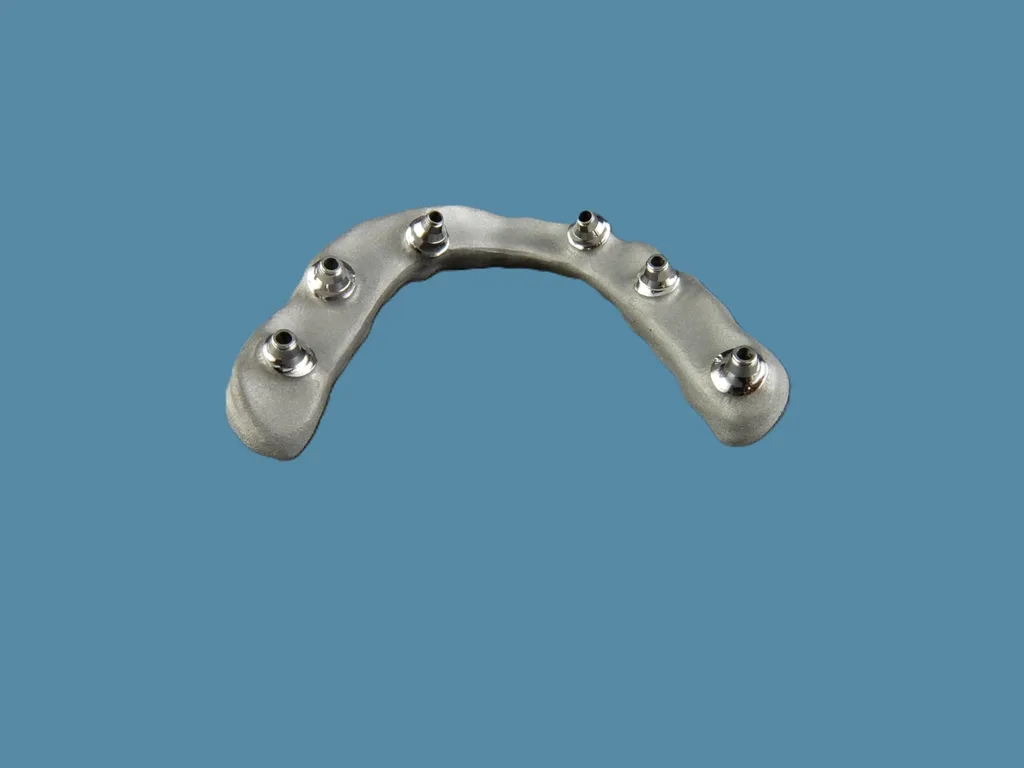 Abb. 4c: Auf Grundlage der Wachsaufstellung wurde ein Cut-back am Gerüst für Kronen und Gingiva-Anteil vorgenommen.