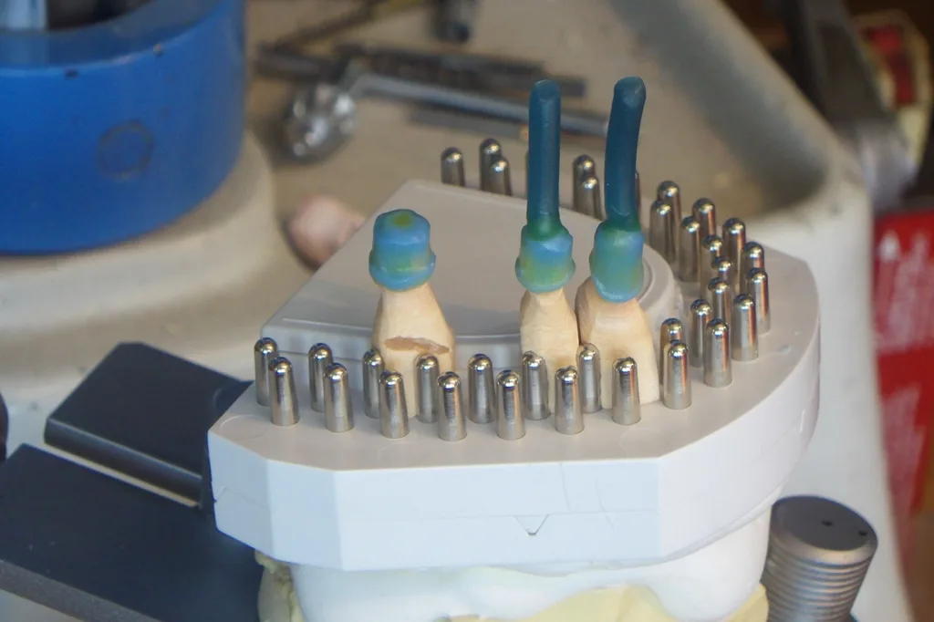 Abb. 16: Modellation der Primärkronen mit deutlicher Hohlkehle.
