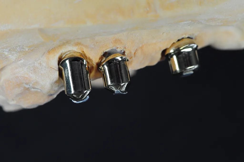 Abb. 22: Innenteleskope mit 0,3-mm-Zinnfolie fertig vorbereitet zum Einsetzen.