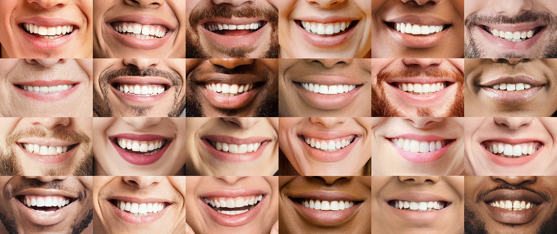 Collage, of different multiracial people cropped smiles, dentistry concept