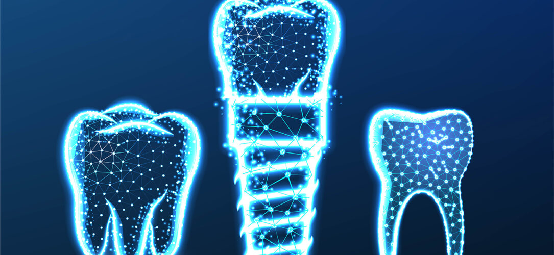 Tooth, dental implant. Abstract Low Poly wireframe Mesh Design. Vector Illustration