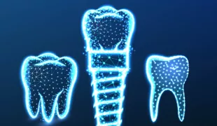 Tooth, dental implant. Abstract Low Poly wireframe Mesh Design. Vector Illustration
