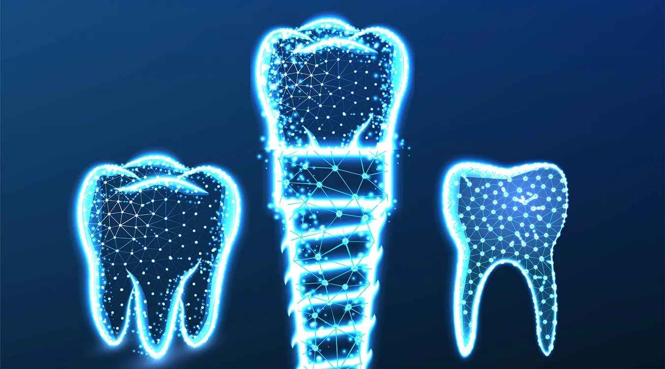 Tooth, dental implant. Abstract Low Poly wireframe Mesh Design. Vector Illustration