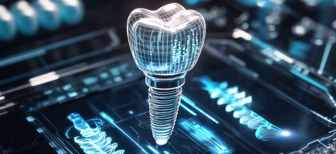 3D model of dental implant, digital design, technology, medical, futuristic