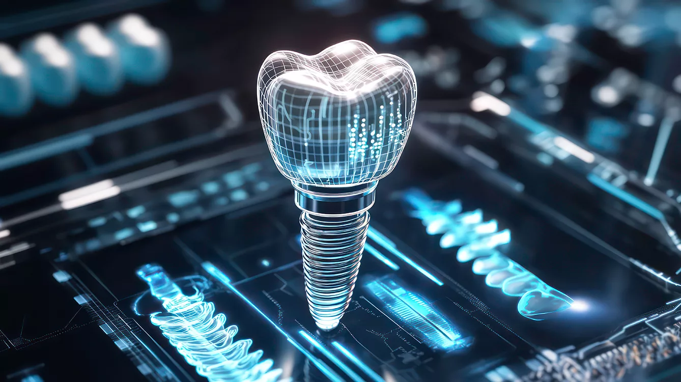 3D model of dental implant, digital design, technology, medical, futuristic