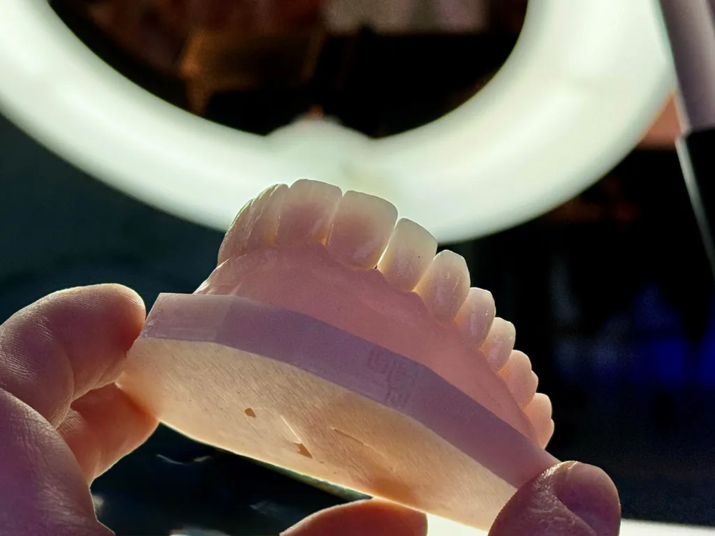 Abb. 2: Die Lichtdurchlässigkeit dieser gefrästen Restauration zeigt die natürliche Transluzenz von zirkonverstärkter Glaskeramik. Selbst im kristallisierten, ausgehärteten Zustand scheinen die Zahnstümpfe noch im Gegenlicht.