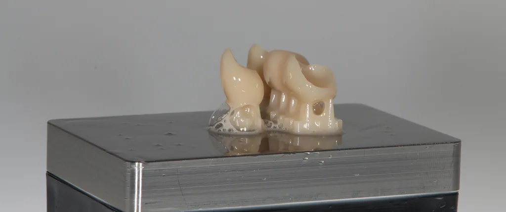 Abb. 6: Permanenter 3D-gedruckter Zahnersatz aus VarseoSmile TriniQ (BEGO). Zustand direkt nach dem Druck. Zu beachten sind der Materialüberschuss und die Gestaltung der Stützstrukturen.