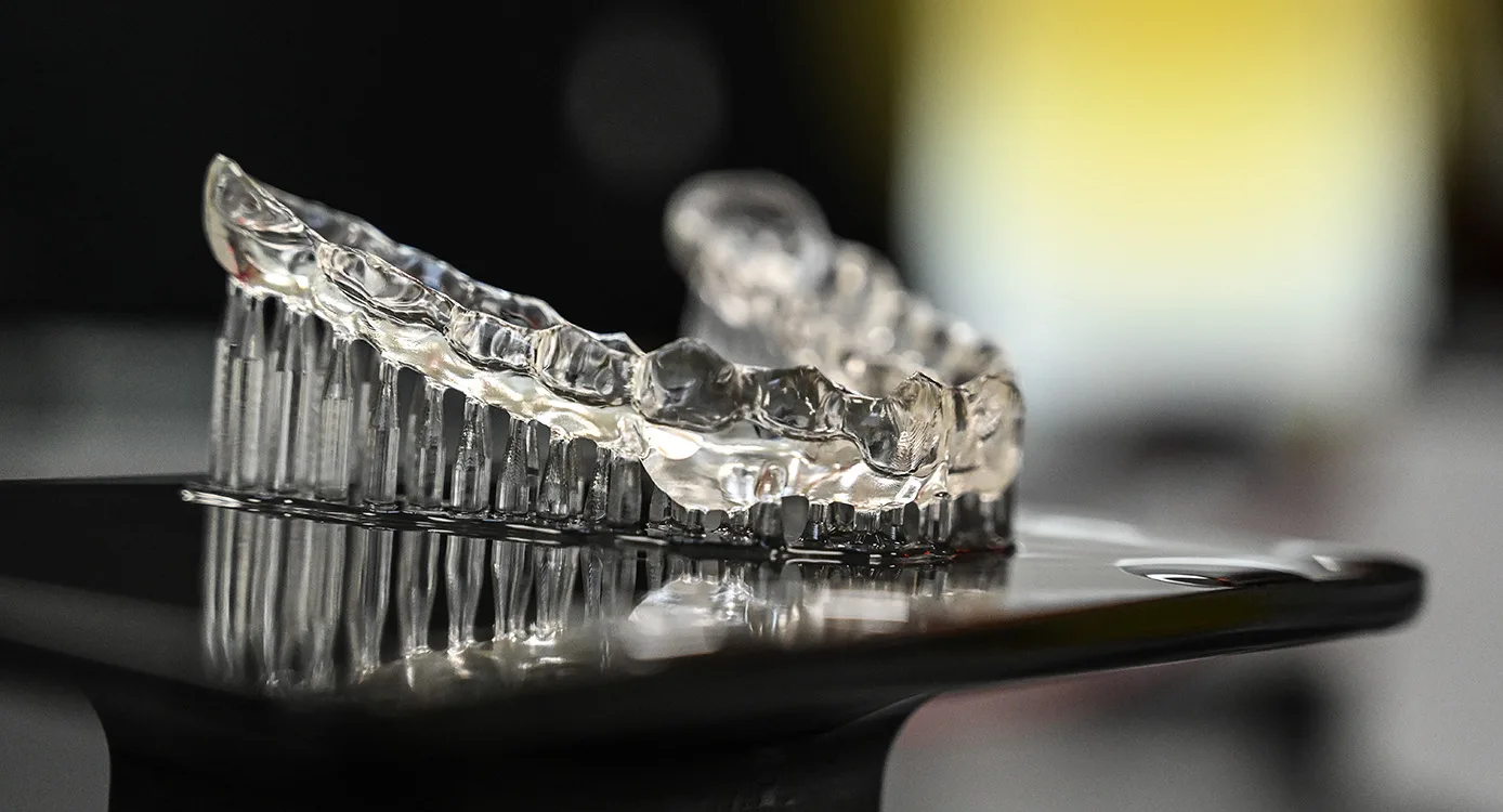 Dental Zahnschiene aus dem 3D-Drucker zur Zahnkorrektur oder bei