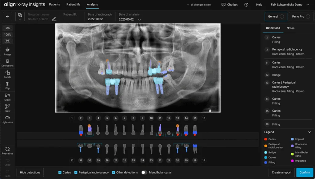 Abb. 1: Ein KI-basiertes System zur Röntgenbildanalyse. Befunde werden pixelbasiert markiert und einzelnen Zähnen zugeordnet. Letzeres erlaubt die automatische Erstellung eines Befundberichts. Das System (align x-ray insights, align technologies, Berlin, Germany) erlaubt die Analyse von Einzelbildern, Bissflügel und – wie hier – Panoramaschichtbildern, auf Karies, apikale Läsionen usw.