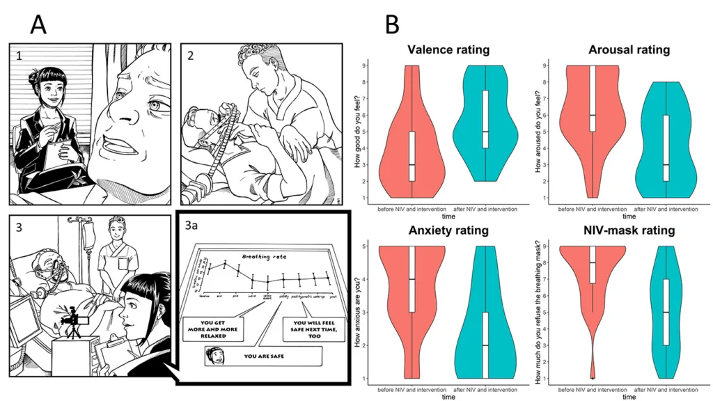 Abb. 1: Hypnose hilft Patientinnen und Patienten in der Intensivstation, die künstliche Beatmung besser anzunehmen. a): Hier sehen Sie den Ablauf der Studie. Wir schlossen hoch ängstliche Patientinnen und Patienten in die Studie ein (1). Die nichtinvasive künstliche Beatmung wurde wie gewohnt durchgeführt (2), wir begleiteten die Sitzung mit Hypnose und positiven Suggestionen (3), wobei wir auch den Vitalmonitor mit aufzeichneten. So konnten wir feststellen, wie die Suggestionen die physiologischen Parameter beeinflussen, zum Beispiel die Atemfrequenz (3a), die merklich abnahm, was für körperliche Entspannung spricht. Rechts b): Die subjektiven Bewertungen der Patientinnen und Patienten vor und nach der Intervention zeigen signifikante Verbesserungen. Sie fühlen sich besser, sind weniger aufgeregt, haben weniger Angst und bewerten die Atemmaske insgesamt positiver.