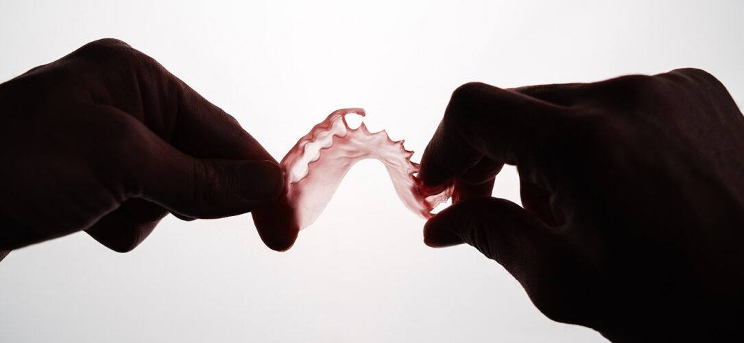 Das von der FDA zugelassene FP3D-Harz ermöglicht Dentallaboren eine zuverlässige, wirtschaftliche und schnelle Herstellung flexibler Teilprothesen.