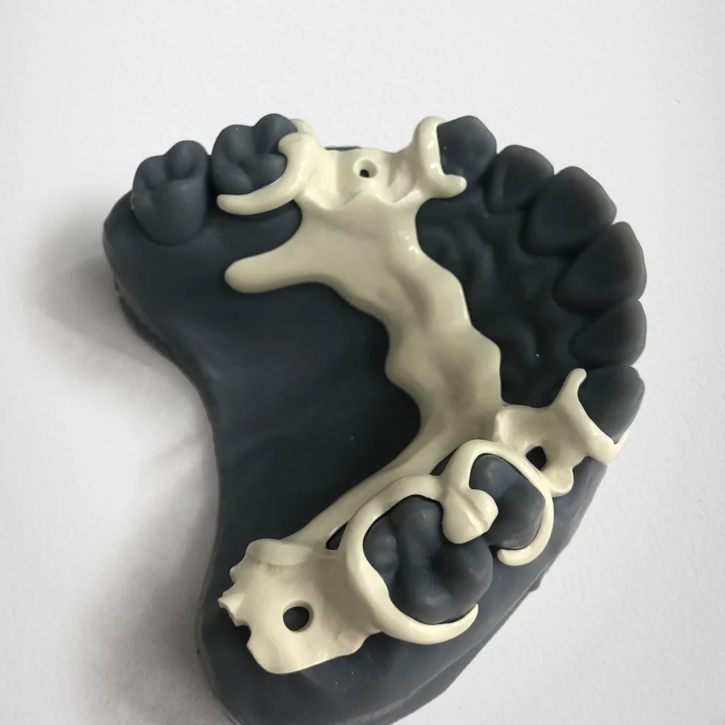 Abb. 3: Moderne Fertigungstechniken ermöglichen die Herstellung von metallfreien Klammerprothesen: Der Hochleistungskunststoff für die Prothesenbasis lässt sich nur auf einer Fräsmaschine bearbeiten. Für die Fertigstellung kann ein 3D-gedrucktes Modell verwendet werden. So lassen sich auch Teilprothesen komplett digital und ohne Abdruck fertigen. Ein Beispiel für den sinnvollen komplementären Einsatz von additiver und subtraktiver Fertigungstechnologie.