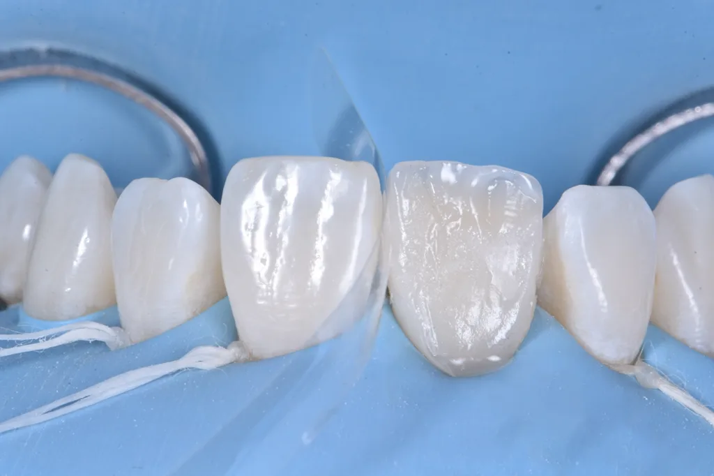 Abb. 10: Verwendung hellblauer und weißer Effektfarben.