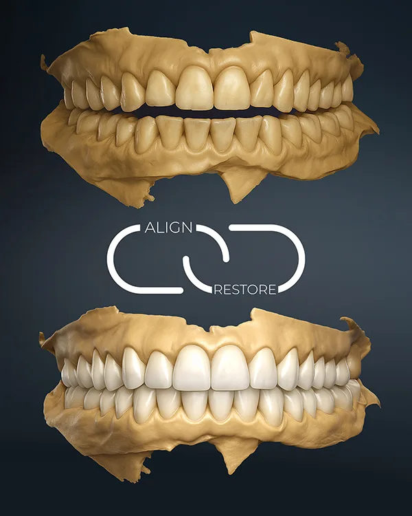 TrioClear_Align Restore_2 (002)