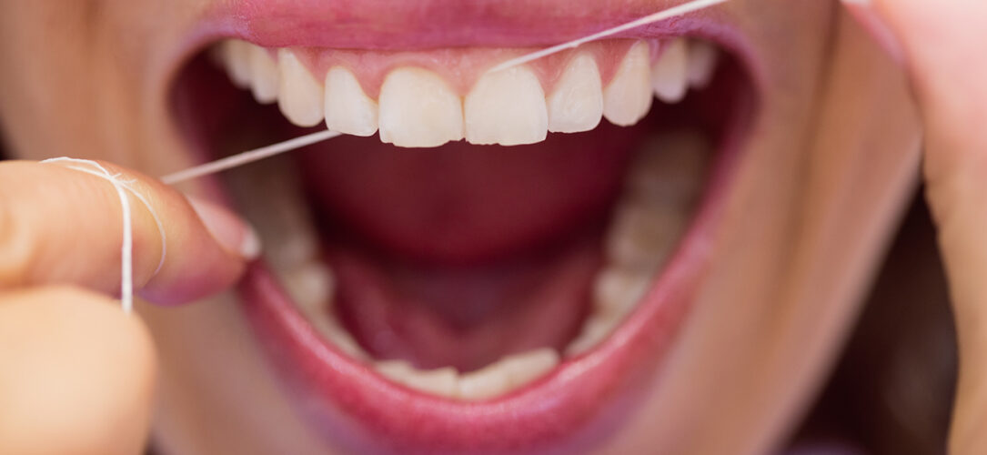 Close-up of female patient flossing her teeth in dental clinic
