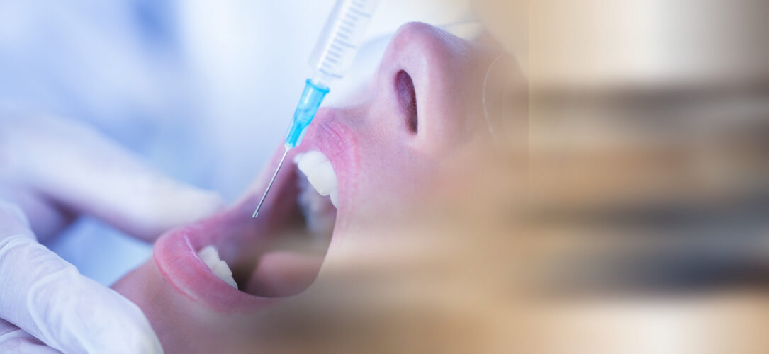 zahnmedizinische Lokalanästhesie