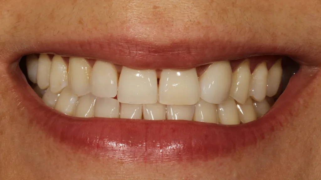 Abb. 22: Die Patientin ist mit ihrer Neuversorgung sehr zufrieden.