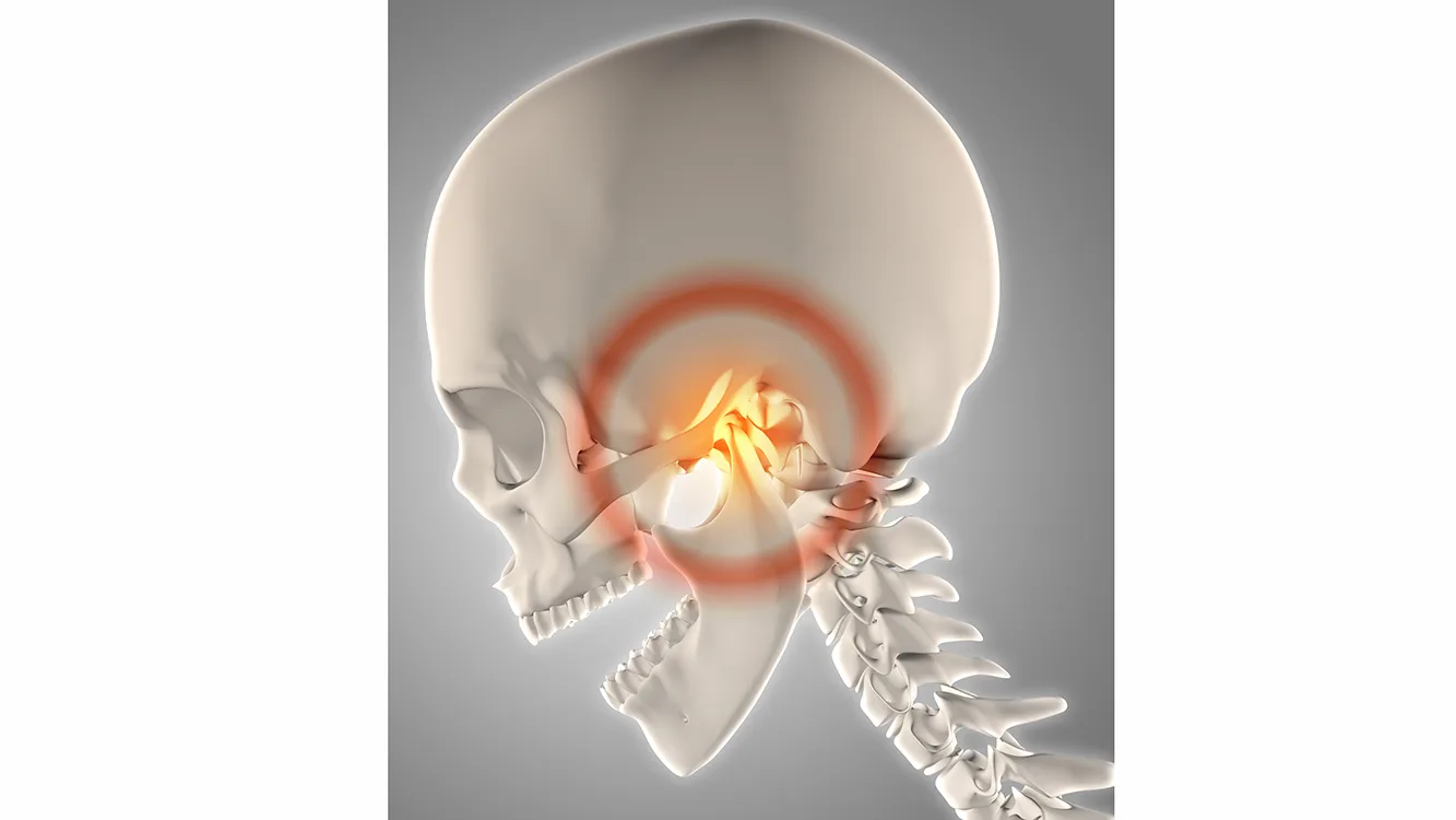 3D render of a skeleton with jawbone highlighted to show pain