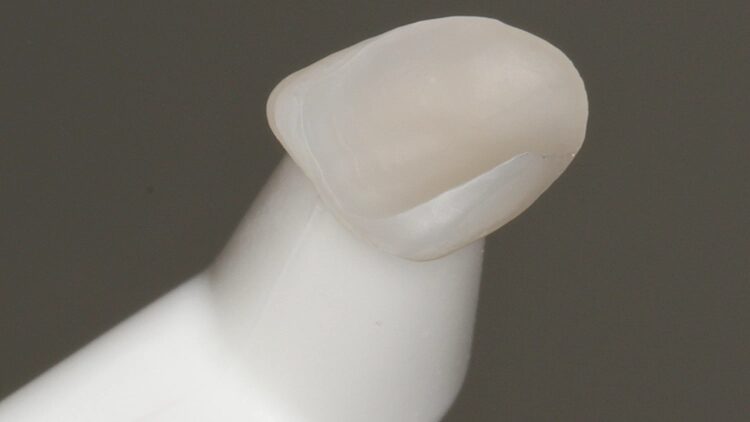 Abb. 6: Die mit SilJet abgestrahlte Zirkonoxid-Klebefläche des Veneers für Zahn 12.