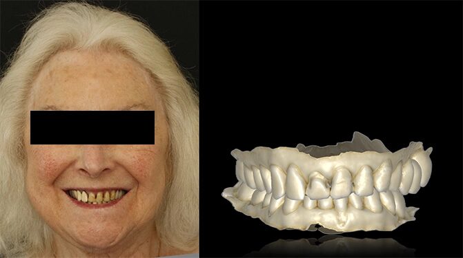 Abb. 1: Ausgangssituation der Patientin: Extraoralaufnahme (li.), Intraoralscan (re.)