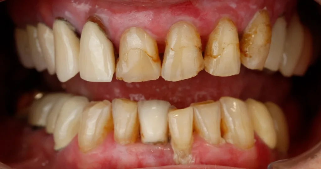 Abb. 2: Nahaufnahme der Ausgangssituation