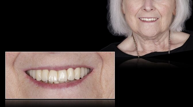 Abb. 6: Provisorium in situ