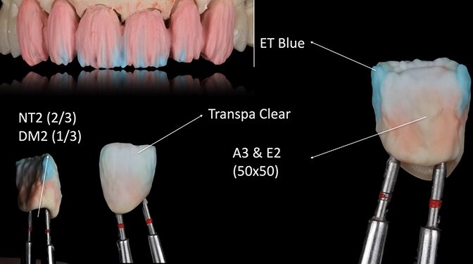 Abb. 7: Schichtschema im Detail