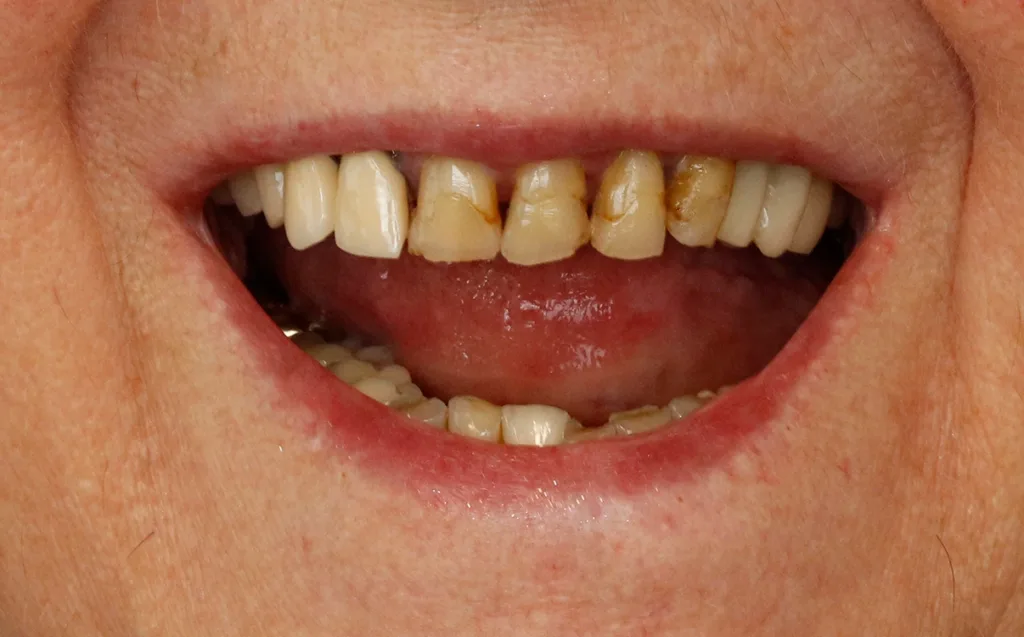 Abb. 10a und b: Gegenüberstellung Ausgangssituation (li.) und Abschlussergebnis (re.)