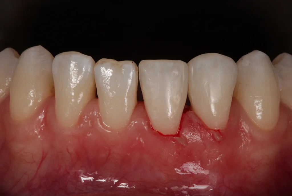 Abb. 10: UK-Front 33 bis 43 (Schlussbild).