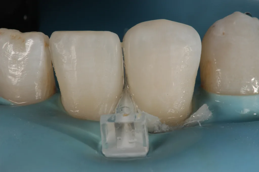 Abb. 8: Ausarbeitung, Politur.