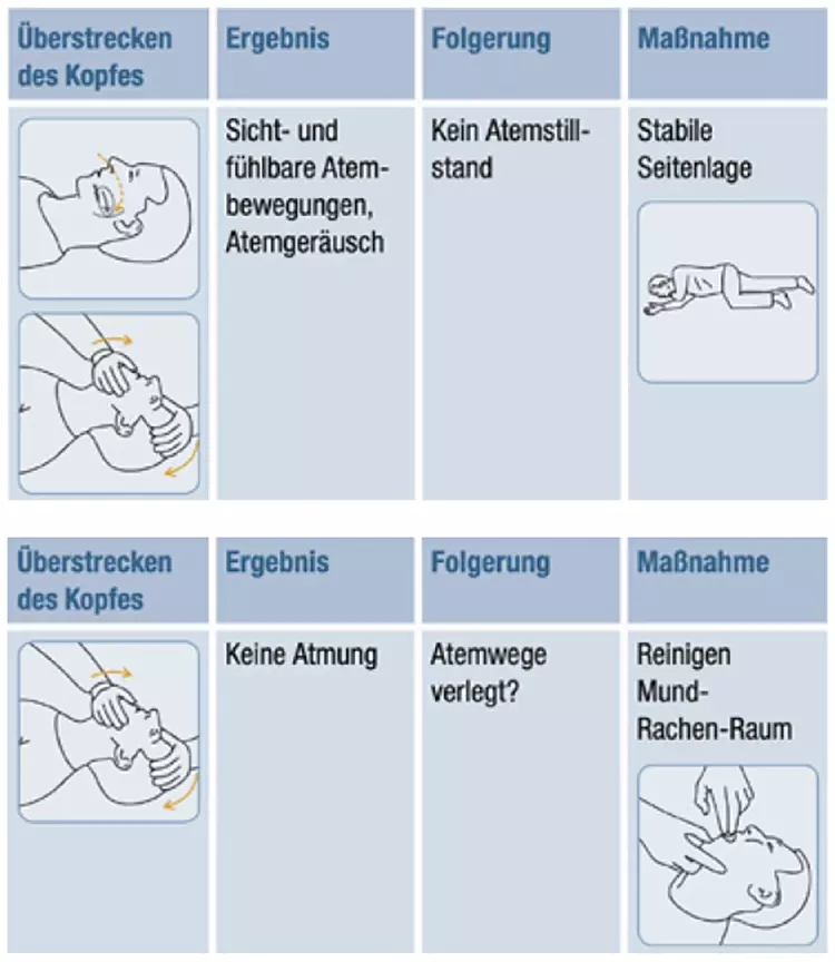 Eine Grafik wie man die Atemwege freimacht.